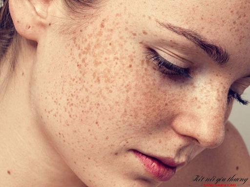 cách chăm sóc da tại nhà khi đi nắng