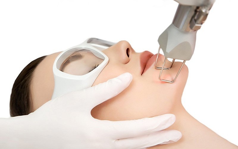 Điều Trị Mụn Không Tái Phát Bằng Laser AviClear – Công Nghệ Được FDA Chứng Nhận