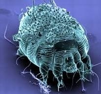 hình ảnh ghẻ ngứa