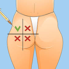 Tiêm Tan Filler: Cảnh Báo Biến Chứng