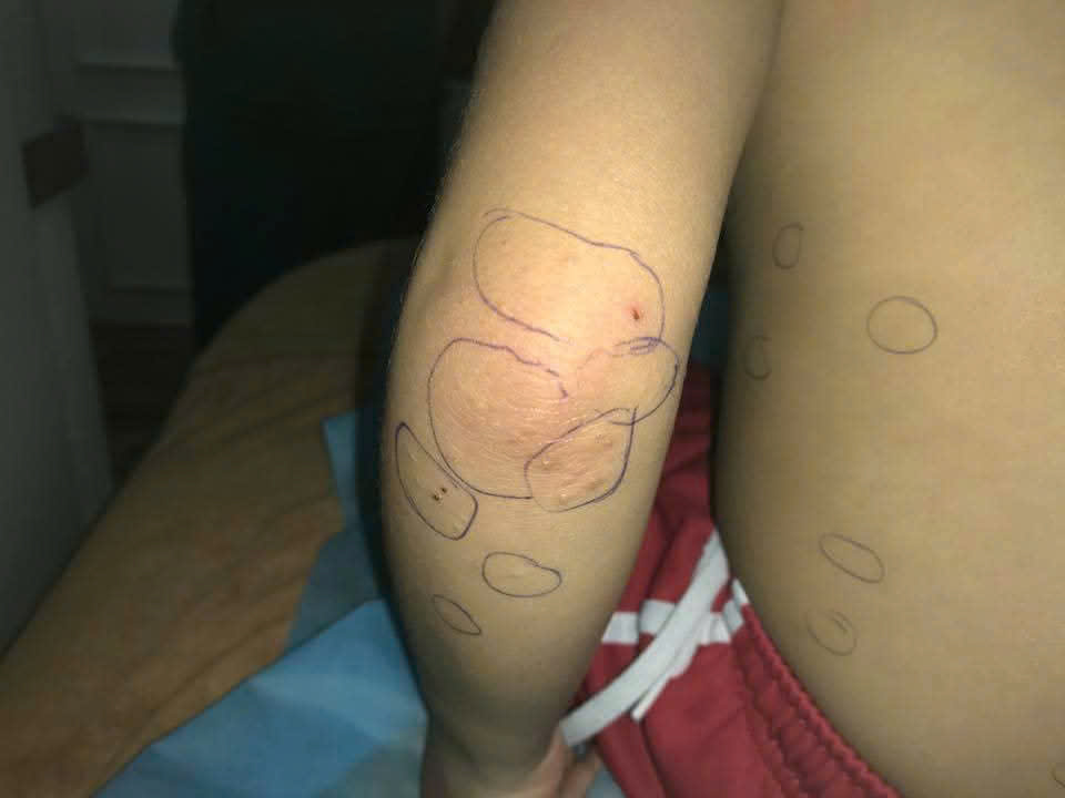 u mềm lây lây không