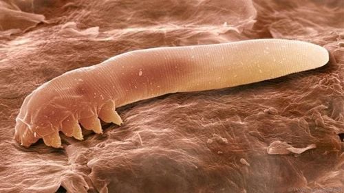 vi khuẩn demodex 
